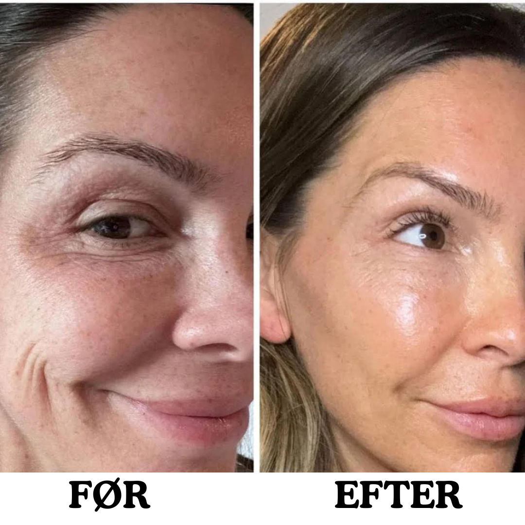 Instalift anti-aging ansigtsstift