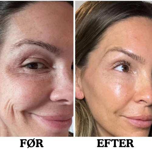 Instalift anti-aging ansigtsstift